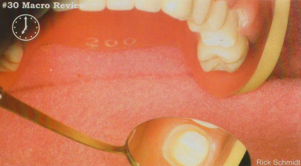 森川精密|右下后牙区的工作体位及口镜使用技巧 - 显微讲堂 - 11