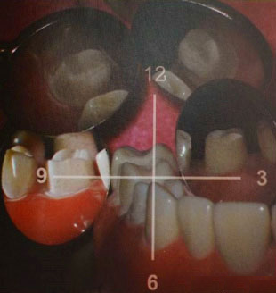 森川精密|左上后牙区的工作体位及口镜基本使用技巧 - 显微讲堂 - 4